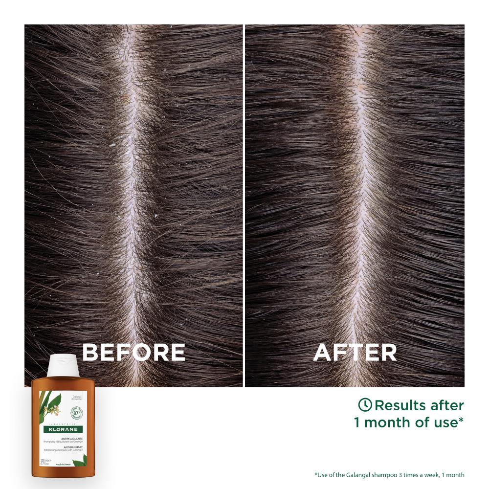 Klorane Σαμπουάν Εξισορρόπησης Κατά της Πιτυρίδας με Galanga Για Ήπια πιτυρίδα 400ml